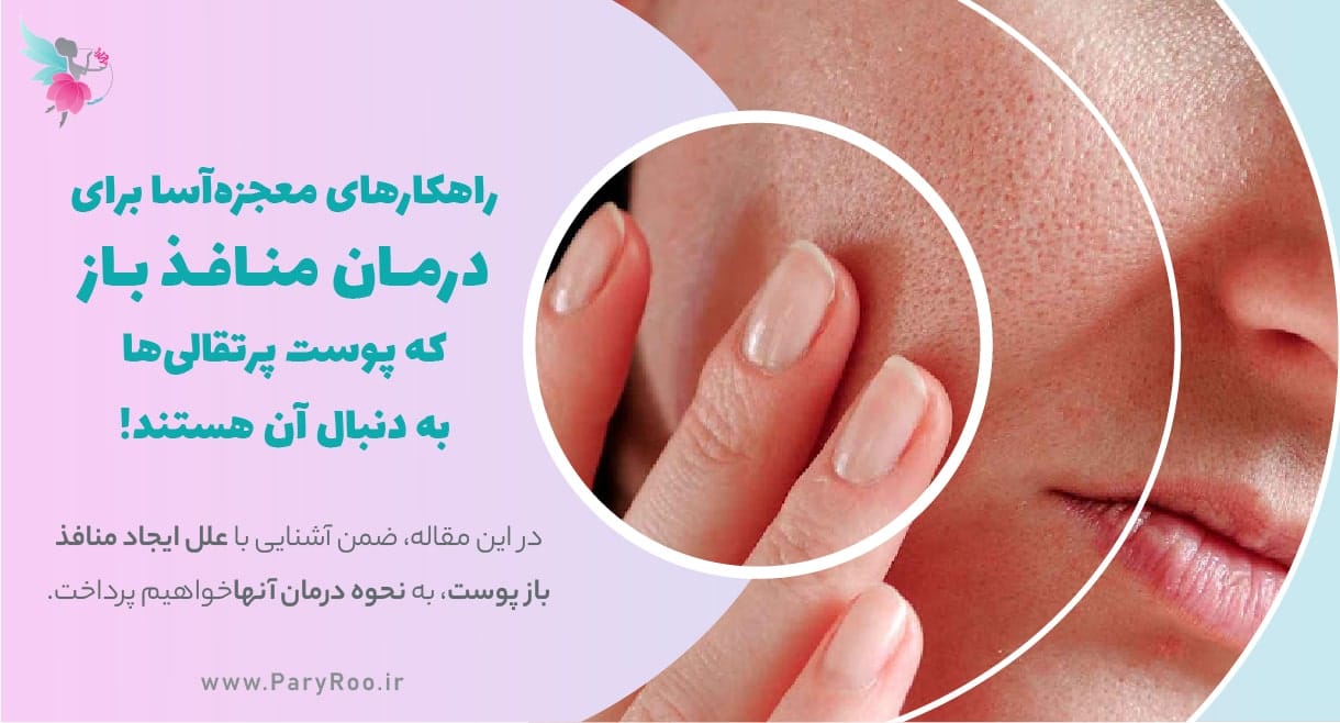 راهکارهای درمان منافذ باز پوست | پری رو