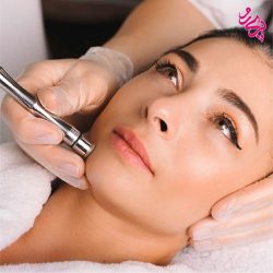 روش های جوانسازی پوست-میکرودرم ابریژن میکرودرم ابریژن | پری رو